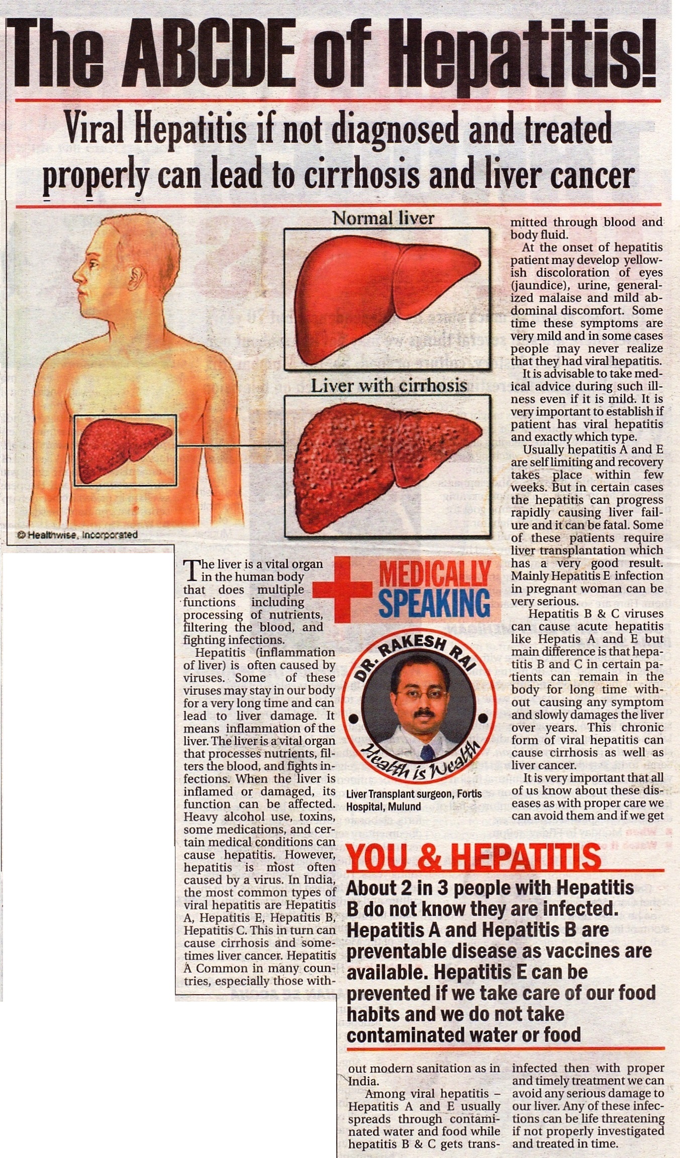 The ABCDE of Hepatitis